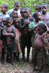 Hungrige-Kinder in Malawi