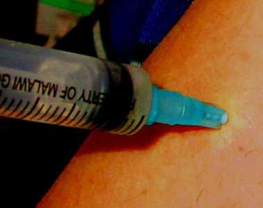 Impfung freiwillig, aber nützlich! Hier Impfung wegen Tollwutverdacht 2014 in Nsanje, Malawi, MSF-Klini